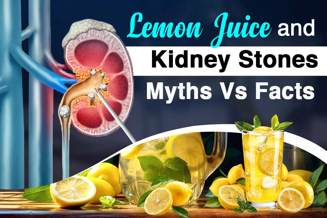 Lemon Juice and Kidney Stones Myths Vs Facts